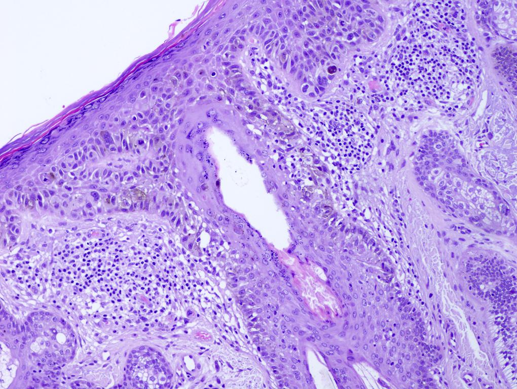 pathology outlines